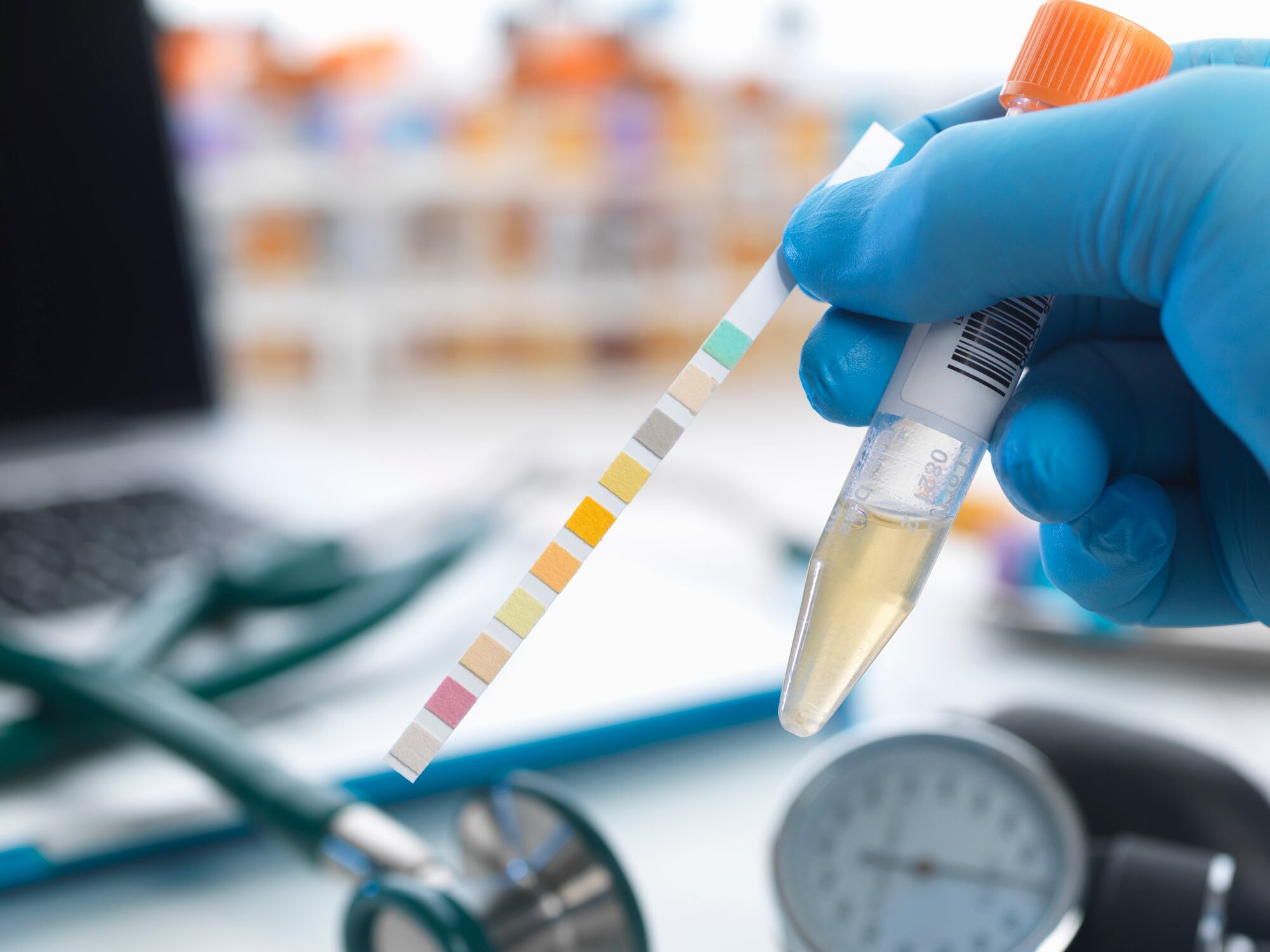 Urine test and immune status: Kirin studies new ways to measure pDC activity