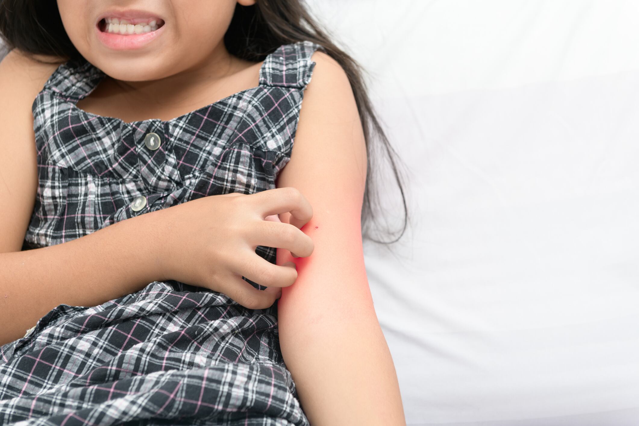 RCT: Vitamin D supplementation assists eczema treatment