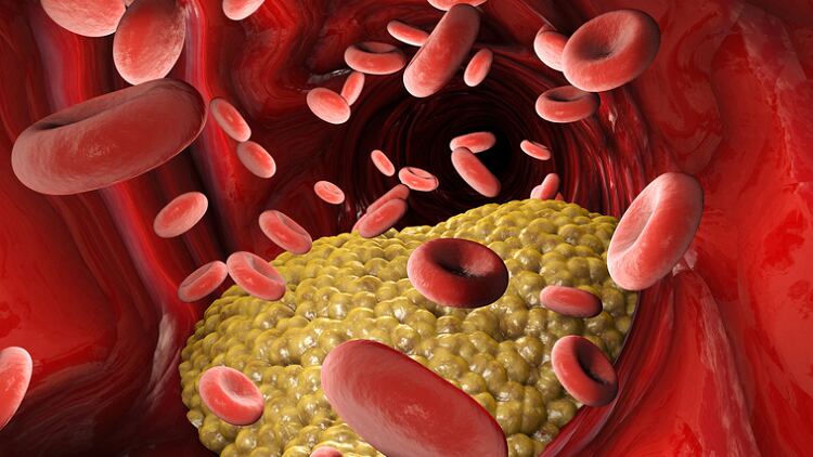 Cholesterol-lowering-aid-Swisse-to-run-human-clinical-trial-on-practitioner-only-formula.png