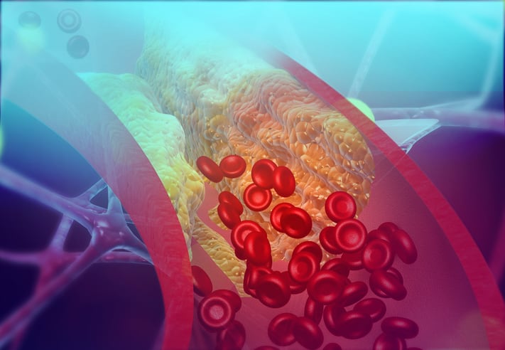 FDA-warns-seven-companies-over-cardiovascular-disease-claims.jpg