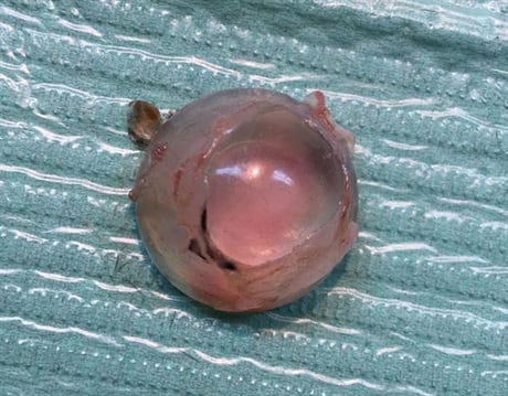 implant-2.jpg
