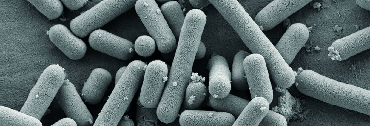 WATCH: Precision probiotics support women’s health directly and via impact in the estrobolome