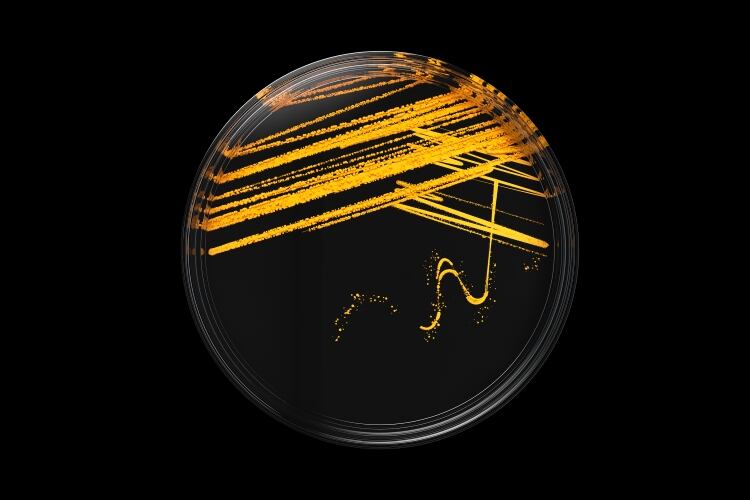 Novozymes-acquires-PrecisionBiotics.jpg