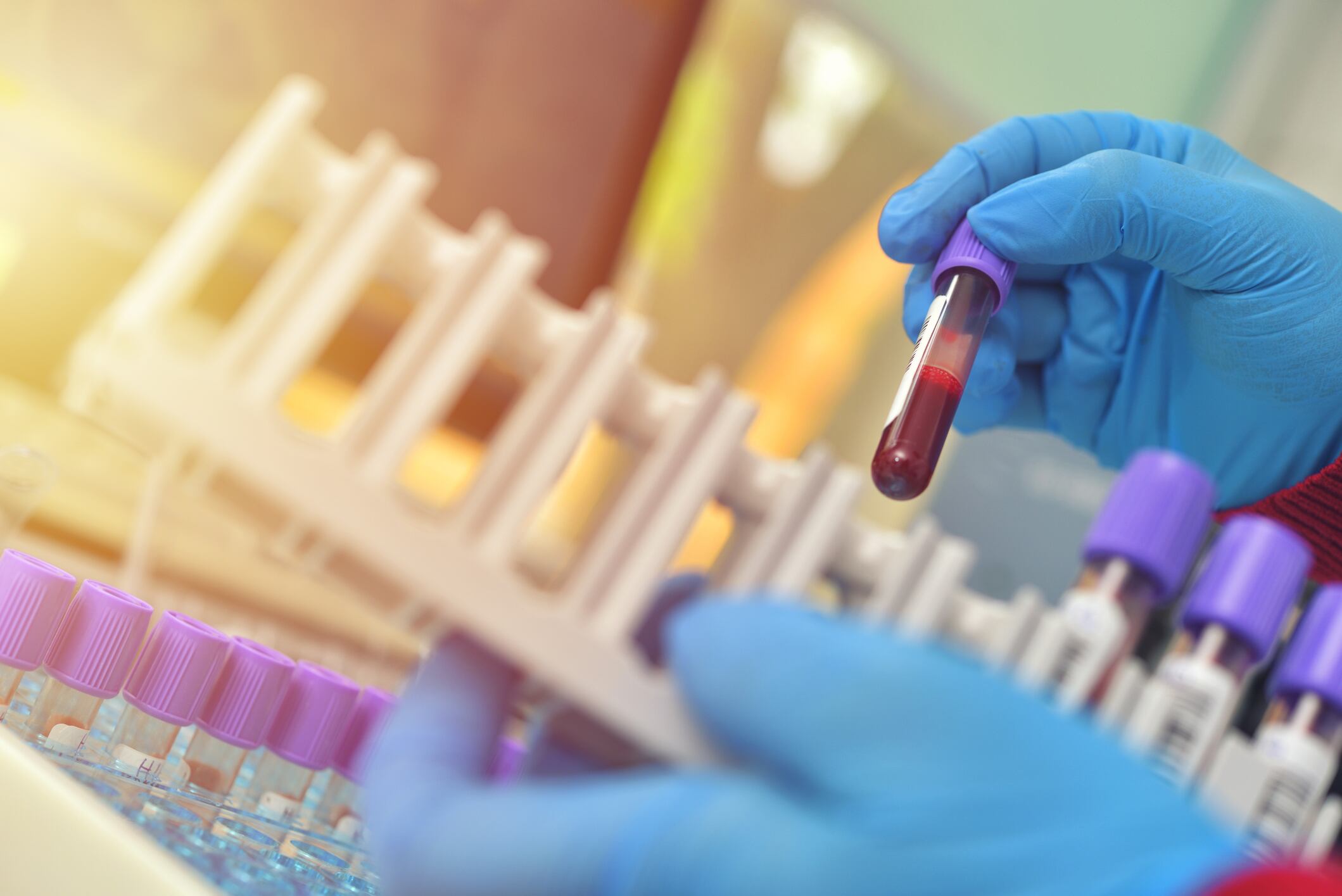 Clinical research: Industry’s scientific substantiation making ‘tremendous strides’ – NutraIngredients-USA webinar panel
