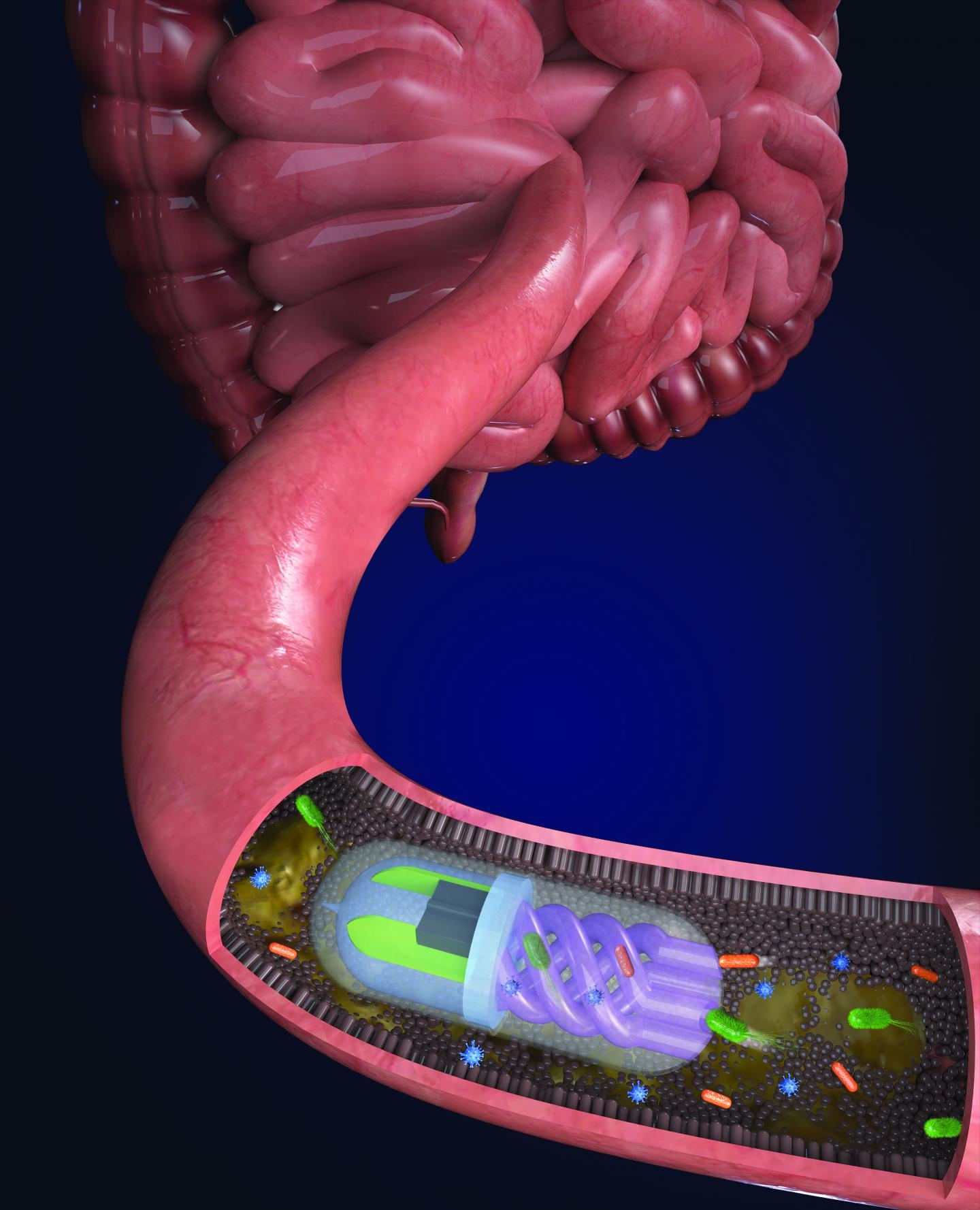 Gut-pill.jpg