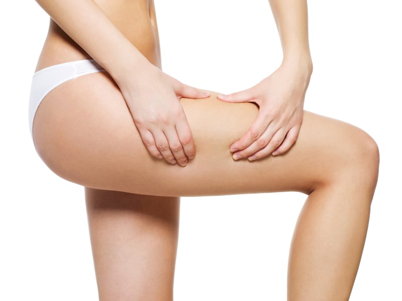 thighs-weight-celulite-iStock.com-ValuaVitaly.jpg