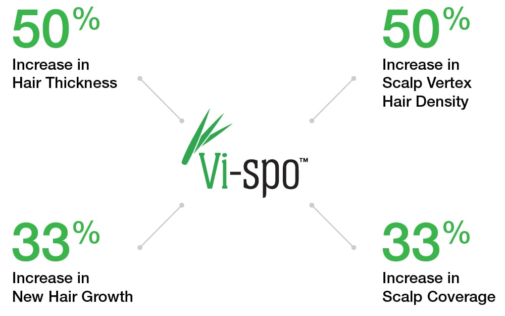 Vispo-Chart-GFX_Vi-spo-chart.jpg