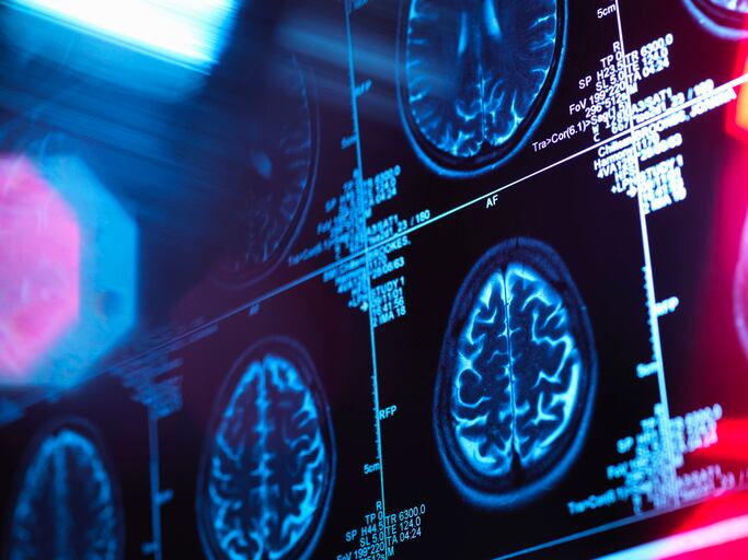 Study: Balancing omega-3 and omega-6 impacts cognitive function