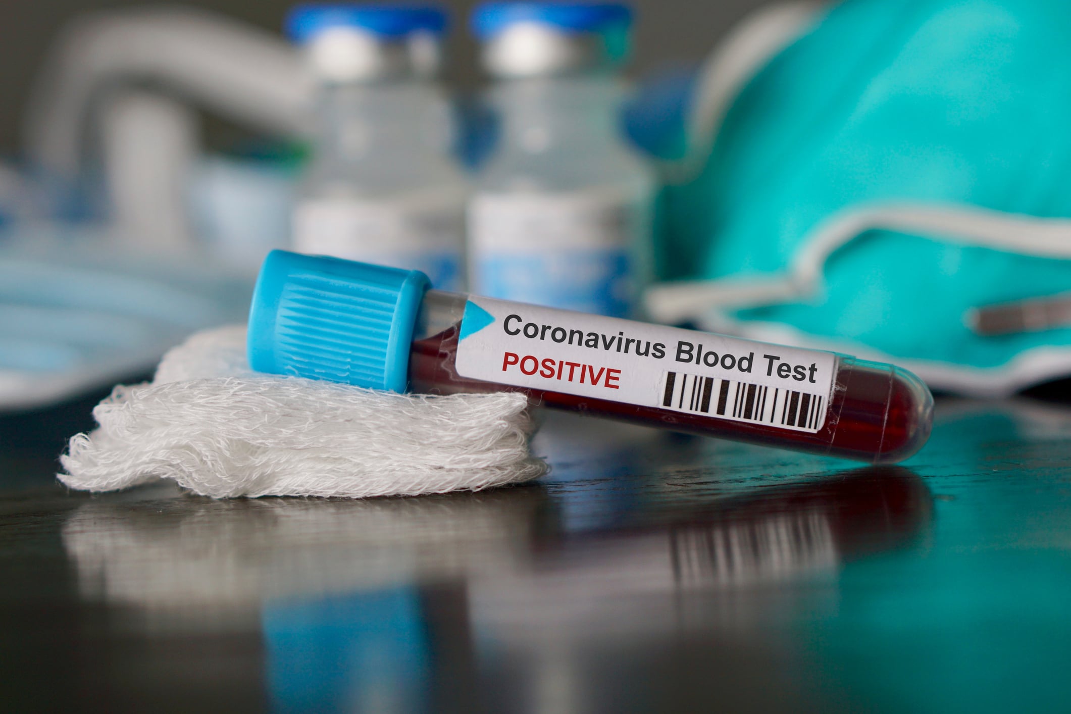 Researchers aim to discover impact of vitamin K on COVID-19