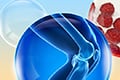 How IRI scan data show UC-II can drive joint health supplement growth