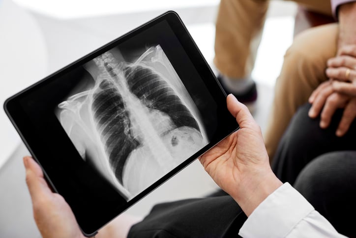 New-probiotic-seeks-to-capitalize-on-growing-awareness-of-gut-lung-axis.jpg