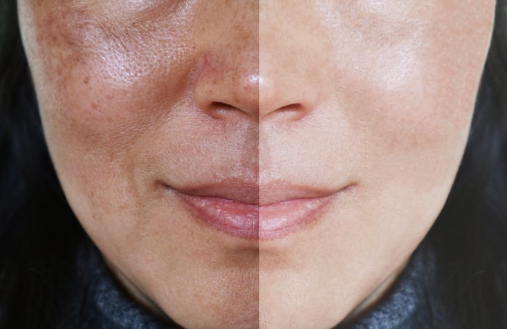Study: Lifestyle, demographic factors account for some of the variations in skin, oral microbiomes