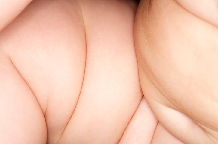 A baby's gut microbiota may forecast future obesity