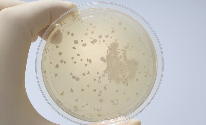 Researchers engineer probiotic yeast to deliver nutrients ‘on-site’