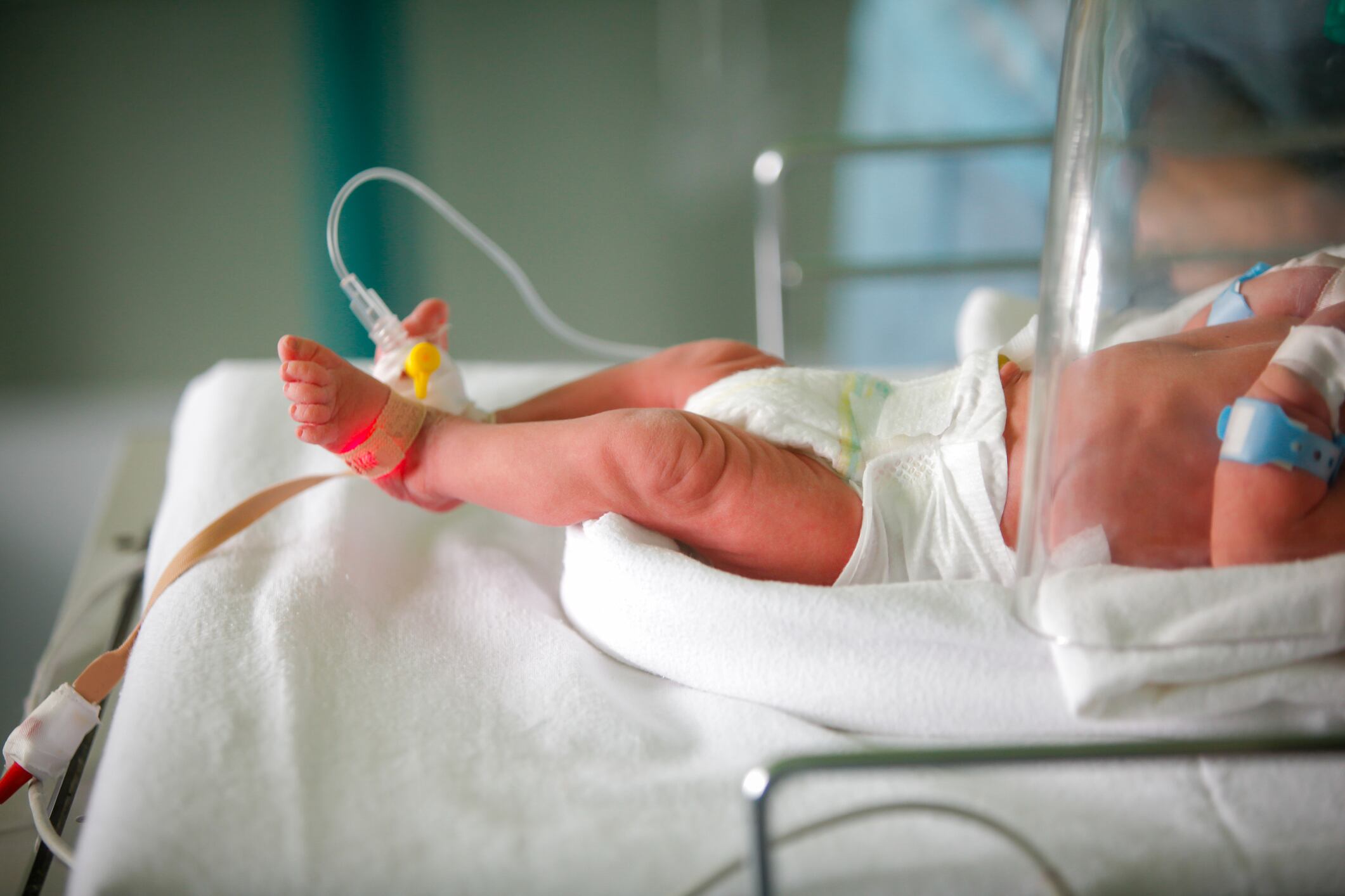 Probiotics for preterm babies reduces risk of hospitalization in first two years