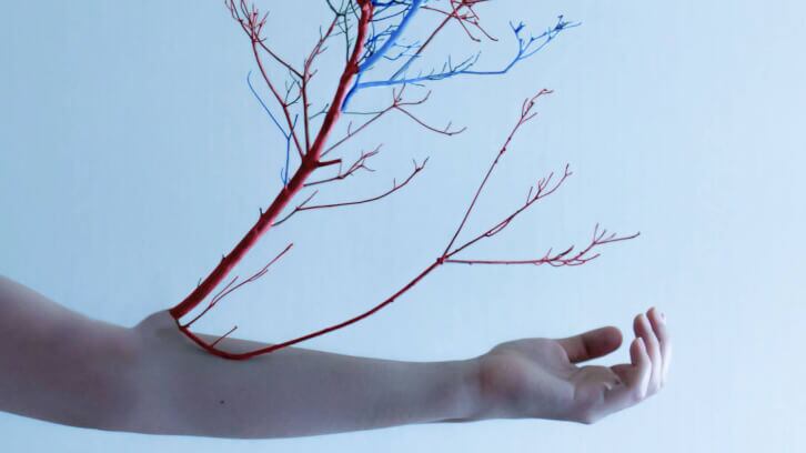 Horphag study expands Pycnogenol use for spider veins post surgery