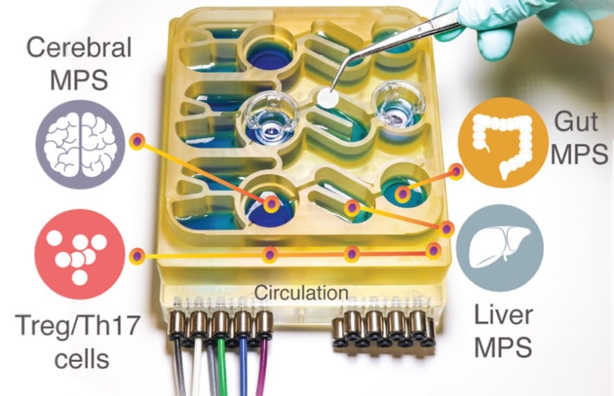  ‘Organs-on-a-chip’ sheds light on gut microbiome’s role in Parkinson’s disease