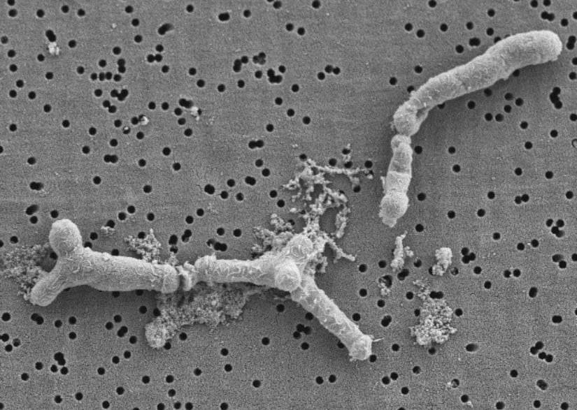 AB-Biotic probiotic blend shows efficacy for infant GI disorders