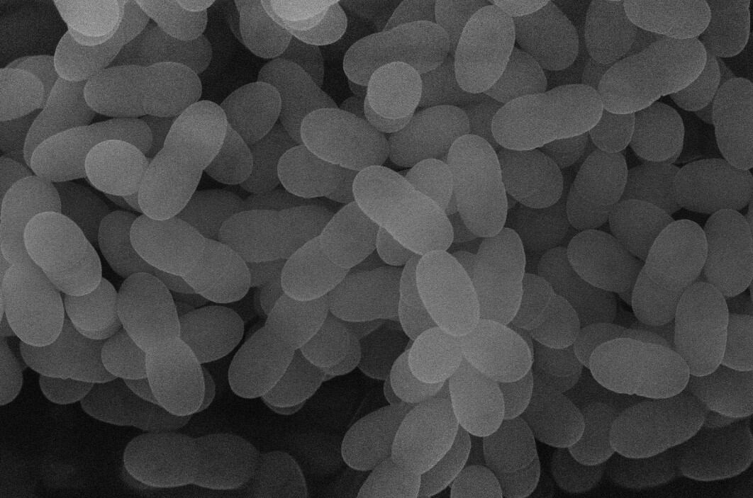 Nagasaki-University-and-Kirin-to-study-lactic-acid-bacteria-on-relieving-symptoms-in-COVID-19-patients.jpg
