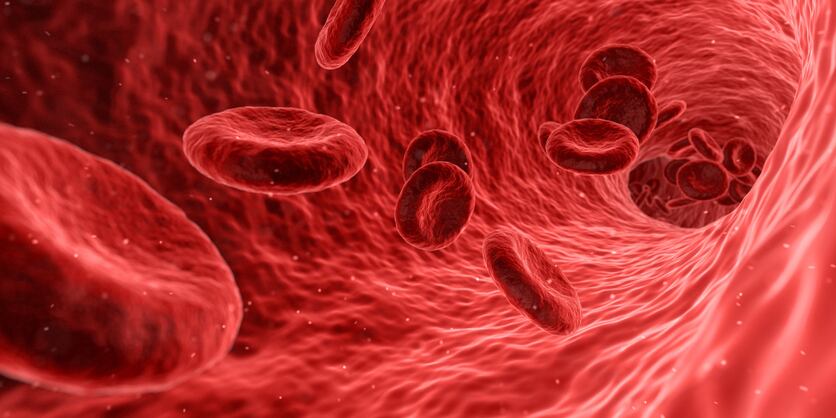 Company patents seaweed ingredient said to fight arterial plaques