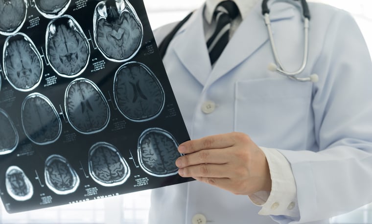 Astaxanthin supplement shows promise in brain health category: Two studies