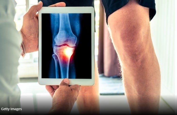 Gelita study finds collagen peptides reduce knee joint discomfort in adults