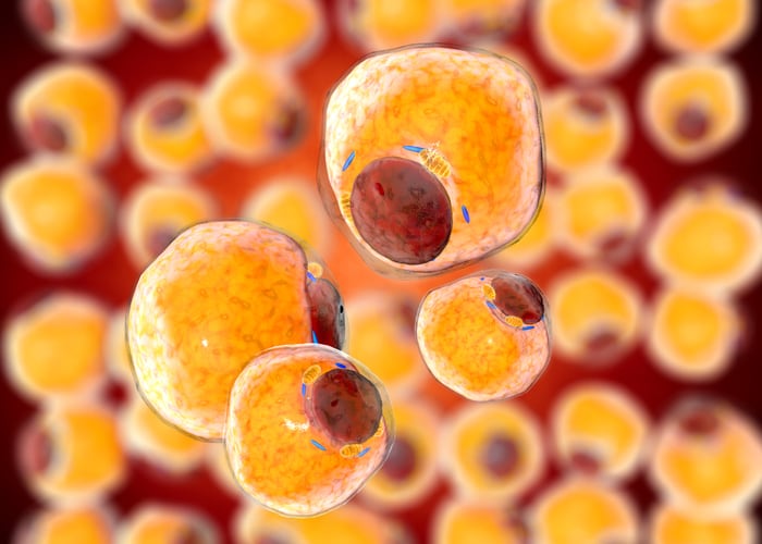 Study reveals potential for N-acetylcysteine (NAC) to reduce obesity complications 