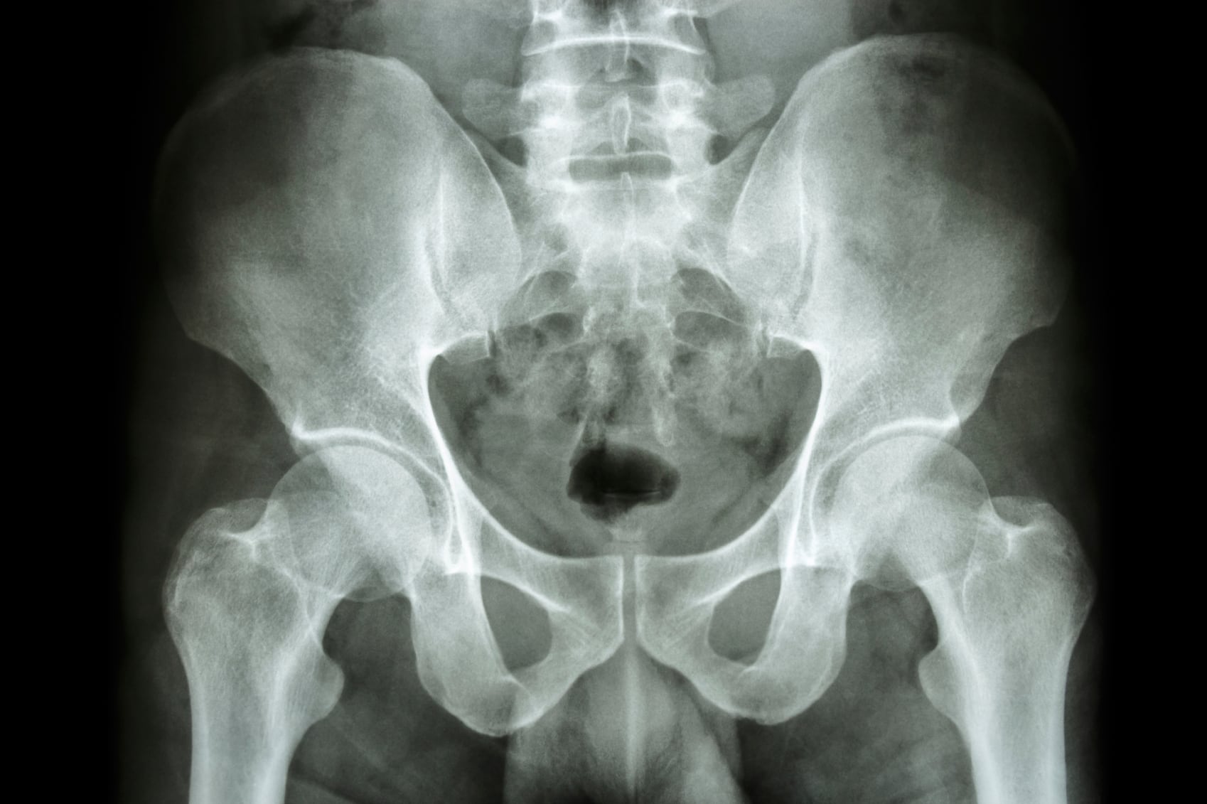 Hips-C-stockdevil.jpg