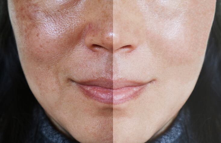 Study-Lifestyle-demographic-factors-account-for-some-of-the-variations-in-skin-oral-microbiomes.jpg