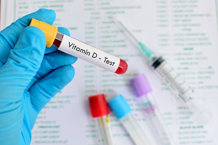 Lockdown, COVID fuel renewed interest on vitamin D