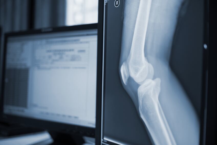 joint-health-knee.jpg