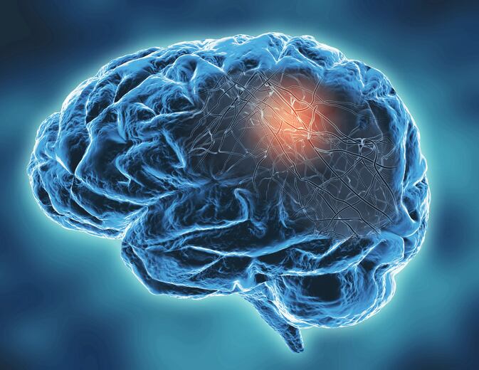 Oxidative stress and gut microbiota's role in neurodegeneration: Review 