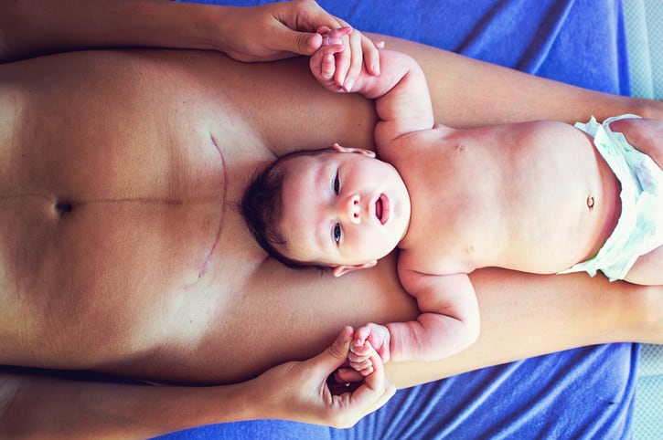 Study: Vaginal 'seeding' confers microbial benefits to C-section babies