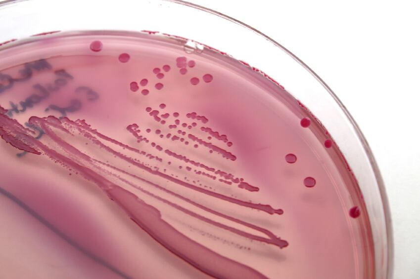 E.coli-agar-plate.jpg