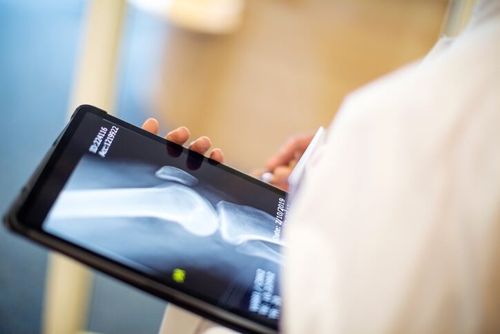 Review investigates n-3 PUFA impact on bone health