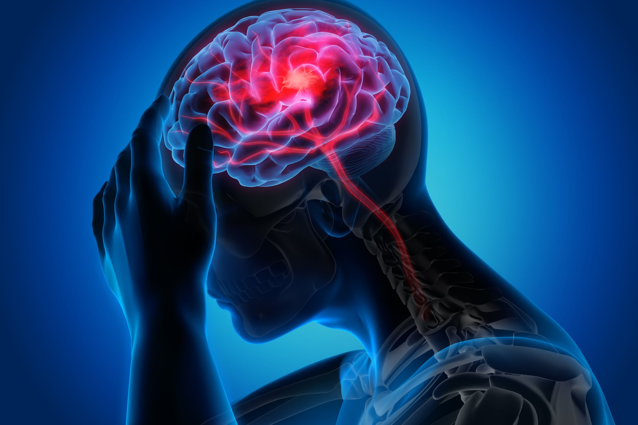 Low-vitamin-D-levels-associated-with-post-stroke-depression-review-suggests.jpg