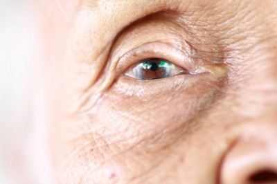 AMD is a leading cause of vision loss among in people over 50. Image © iStock / Photokanok
