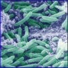 Prebiotics may reduce severity of colitis, say researchers