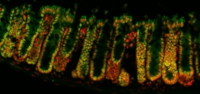 This is an image of the lining of the large intestine of a mouse. DNA is marked in red with the epigenetic marker known as crotonylation shown in green. Yellow shows areas where crotonylation and DNA are found together. Signals from gut bacteria can change the amount of crotonylation in the gut and so influence gene activity. Picture credit:Dr Juri Kazakevych, Babraham Institute  