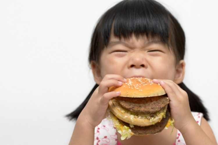 Children with Prader–Willi syndrome (PWS) – a genetic condition that predisposes them to obesity – had similar microbial populations as children with ‘simple’ obesity caused by their lifestyles. Image: © iStockPhoto / Kenishirotie