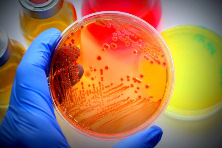 Colony forming units (CFUs) are calculated from probiotic plate counts.  Image © iStock / Ca-ssis