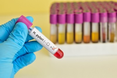 Lonza sells the licence for its H. pylori-fighting probiotic. © iStock.com / jarun011