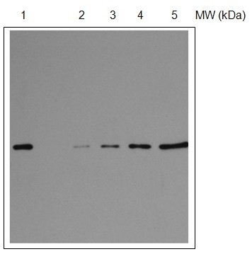 A typical Western Blot