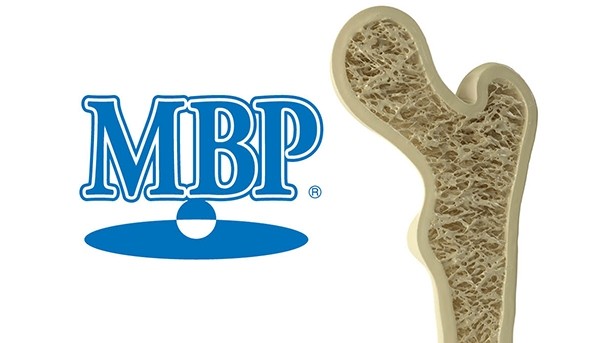 MBP® Intake Improves Bone Density and Slows Down Bone Breakdown