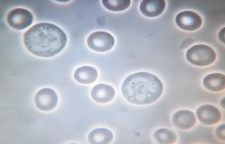 A still from a video that Victory Nutrition claims shows greater blood uptake that results from its delivery technology.